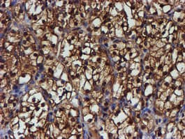 PSMB9 Antibody (clone OTI2B6)