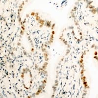 Polyclonal Rabbit anti-Human HMG1 / HMGB1 Antibody (N-Terminus, IHC, WB)