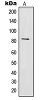 IL31RA Antibody (Internal)