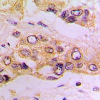 IKBKB / IKK2 / IKK Beta Antibody (Internal)