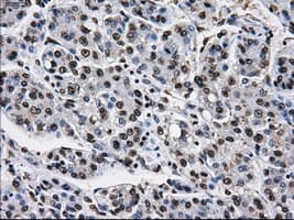 KIAA0153 / TTLL12 Antibody (clone OTI4B2)