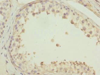 FAM176A / TMEM166 Antibody