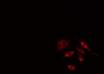 PNPLA6 / NTE Antibody