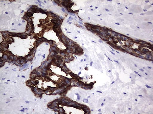 KRT19 / CK19 / Cytokeratin 19 Antibody (aa240-390, clone OTI5G7)