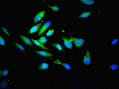 PSMB7 Antibody