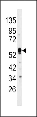 DUSP4 / MKP2 Antibody (aa331-361)