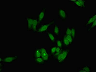 DKC1 / Dyskerin Antibody