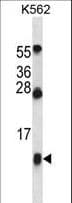 Polyclonal Rabbit anti-Human HBG1 / Fetal Hemoglobin Antibody (aa56-85, WB)