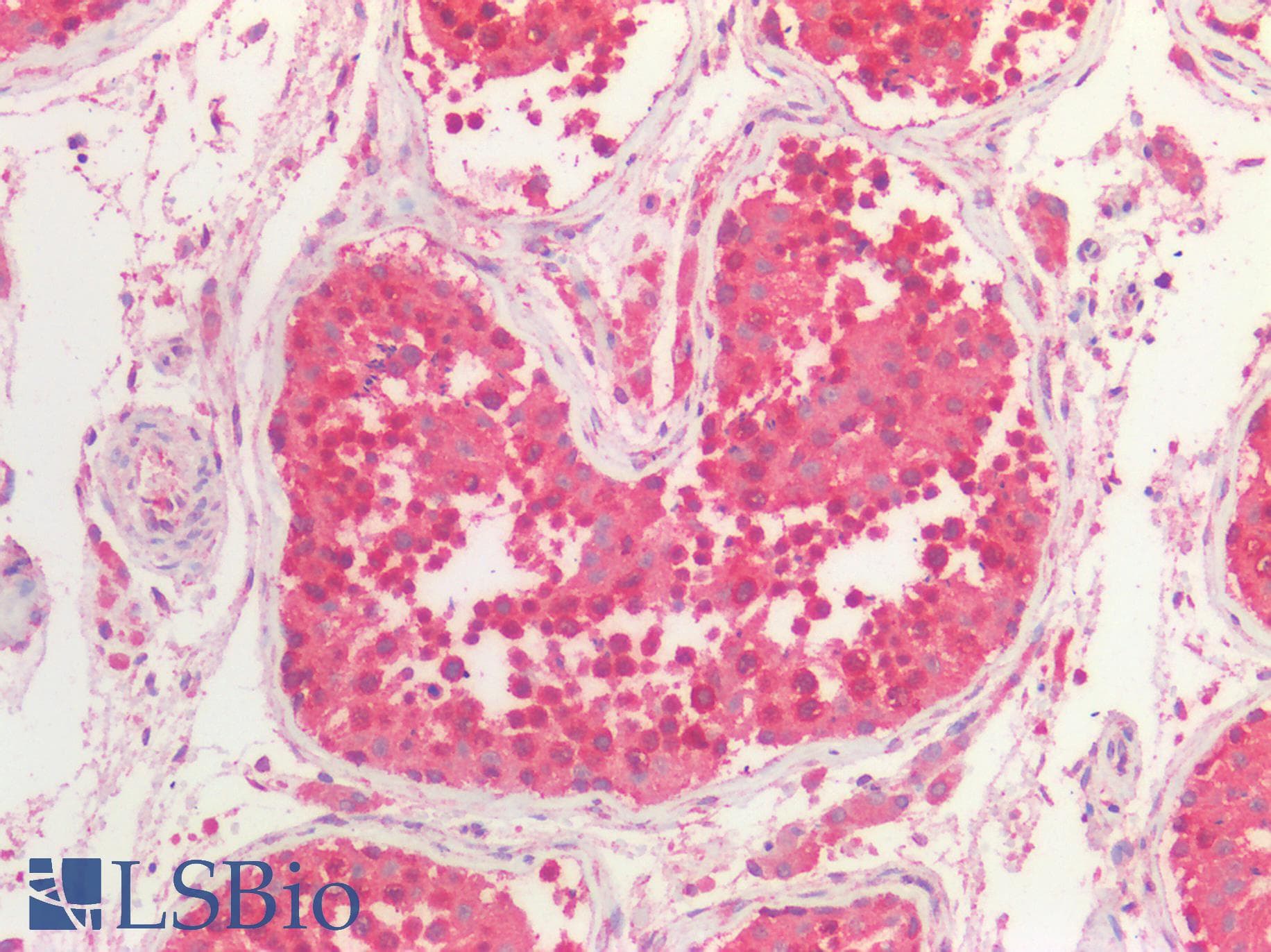 PathPlus™ P4HA1 Antibody (clone 4F1)