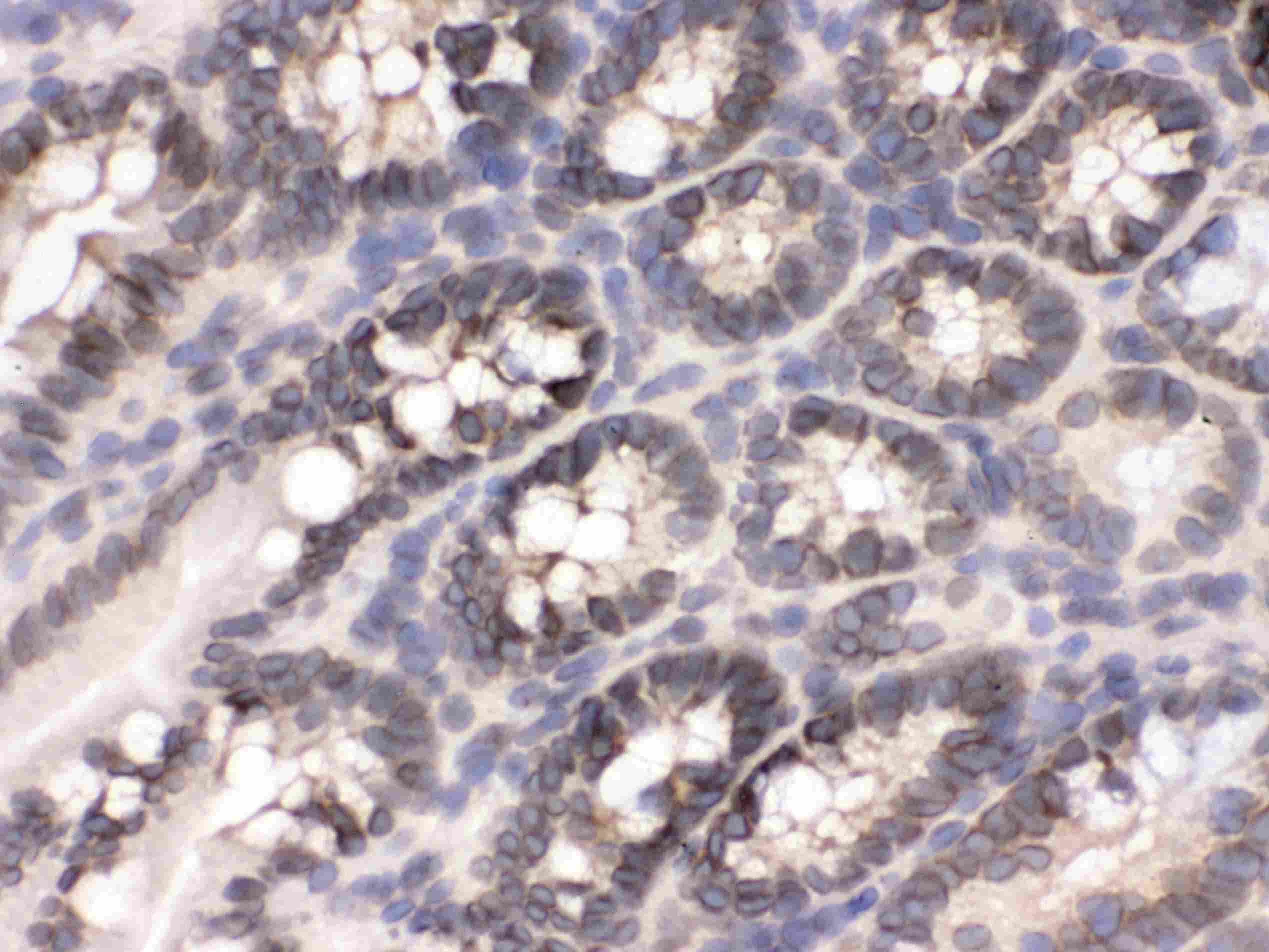 XPO1 / CRM1 Antibody