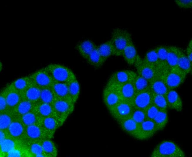 ARRB1 / Beta Arrestin 1 Antibody