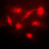 NFKBIB / IKB Beta / IKBB Antibody (phospho-Ser23)
