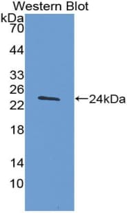 TIMP4 Antibody