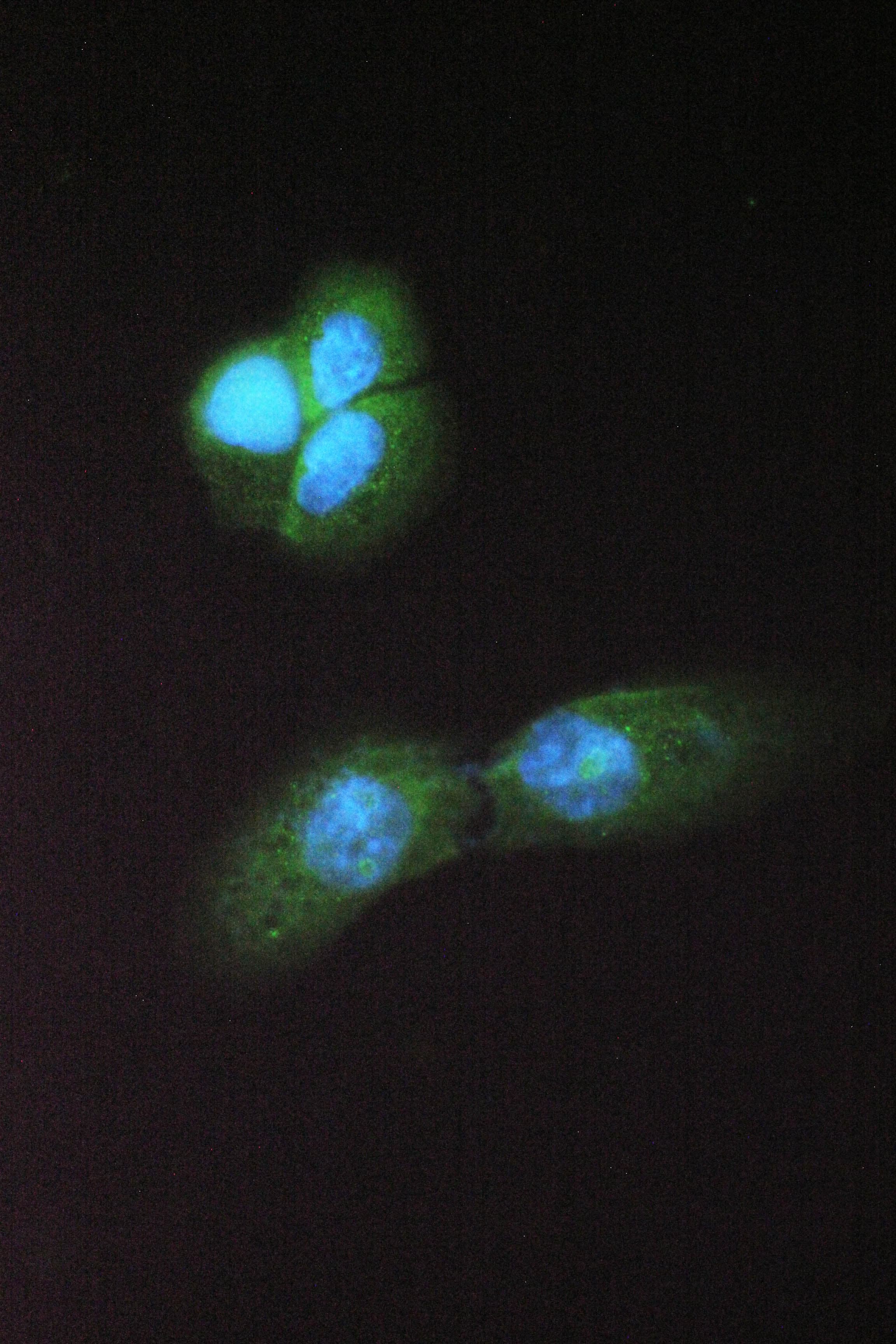 Polyclonal Rabbit anti-Human ABHD5 Antibody (IHC, WB)