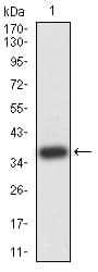 ATG2A Antibody (clone 4E6D4)