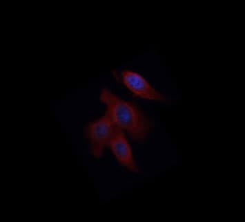 Polyclonal Rabbit anti-Human IL-1B / IL-1 Beta Antibody (IHC, IF, WB)