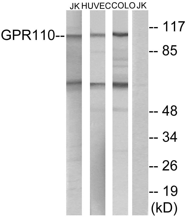 Polyclonal Rabbit anti-Human ADGRF1 / GPR110 Antibody (aa831-880, IF, WB)