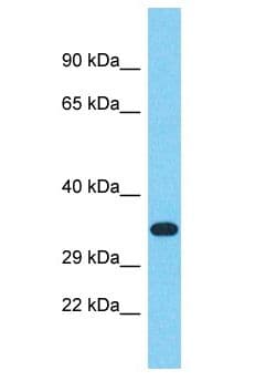 RIBC2 Antibody (aa132-181)