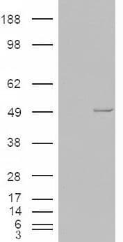IHC-plus™ CSNK1E / CK1 Epsilon Antibody (aa403-416)