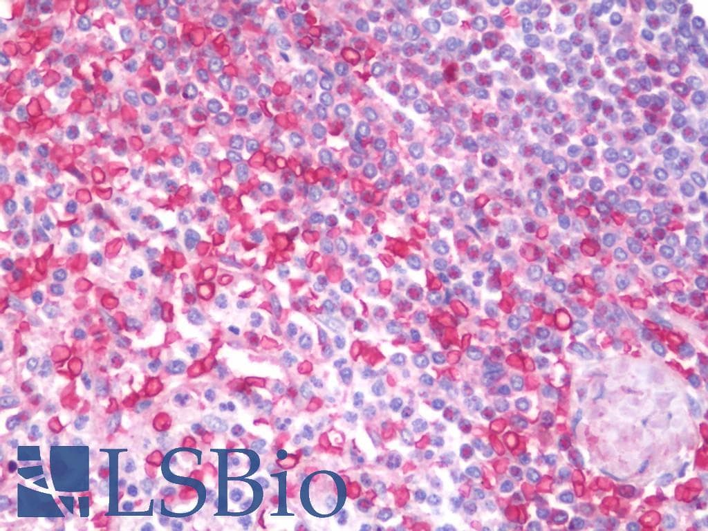 IHC-plus™ Polyclonal Goat anti-Human MIA / CD-RAP Antibody (aa28-40, IHC, WB)