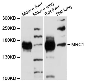 Polyclonal Rabbit anti-Human Mannose Receptor / CD206 Antibody (IHC, WB)