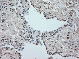 SATB1 Antibody (clone OTI13D6)
