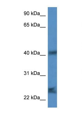 SCAMP1 / SCAMP Antibody (aa49-98)