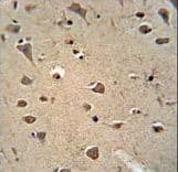 ALDH2 Antibody