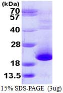 Human PFDN5 / MM1 Protein (Recombinant His)
