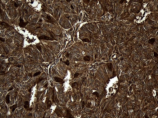 MLC3F / MYL1 Antibody (aa2-150, clone OTI1D9)