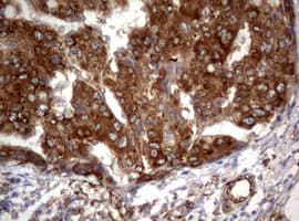 Monoclonal Mouse anti-Human PIK3C2A Antibody (clone OTI2C10, aa230-560, IHC, WB)