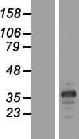 MARCH8 Protein (Over-Expression Lysate Myc-DDK (Flag))