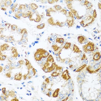CCL2 / MCP1 Antibody