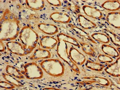 ACAA2 Antibody