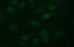 PathPlus™ TH / Tyrosine Hydroxylase Antibody (clone OTI3H3)