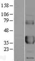 CD32A Protein (Over-Expression Lysate Myc-DDK (Flag))