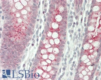 PathPlus™ NGF Antibody (Internal)
