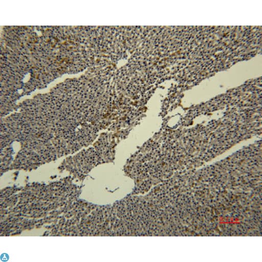 TF / Transferrin Antibody