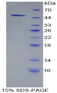 Human PSMC4 Protein (Recombinant His-T7)
