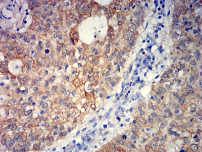 Monoclonal Mouse anti-Human GRM5 / MGLUR5 Antibody (clone 1A11D10, IHC, WB)