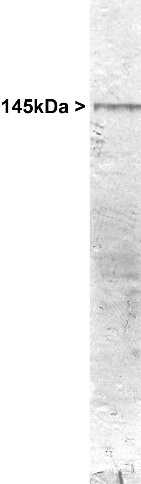 NEFM / NF-M Antibody