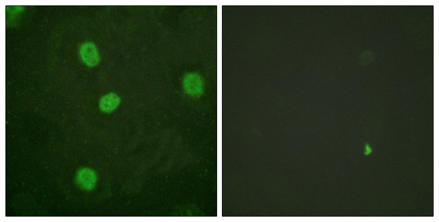 MYBL2 Antibody (phospho-Ser577/581)