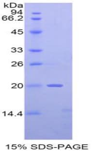 Mouse NME2 Protein (Recombinant His, N-Terminal)