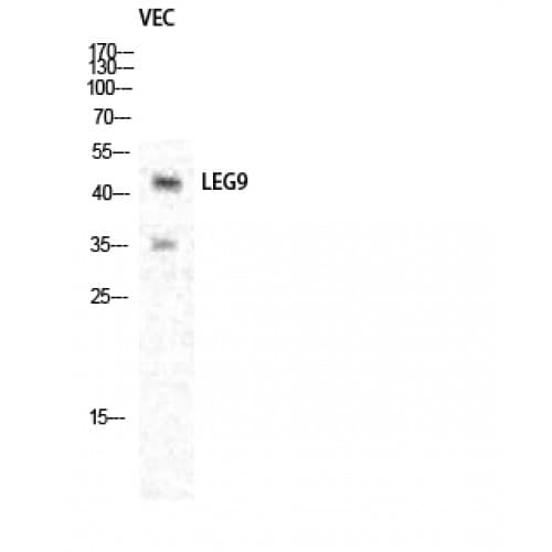 LGALS9 / Galectin 9 Antibody (30-110 aa, Internal)