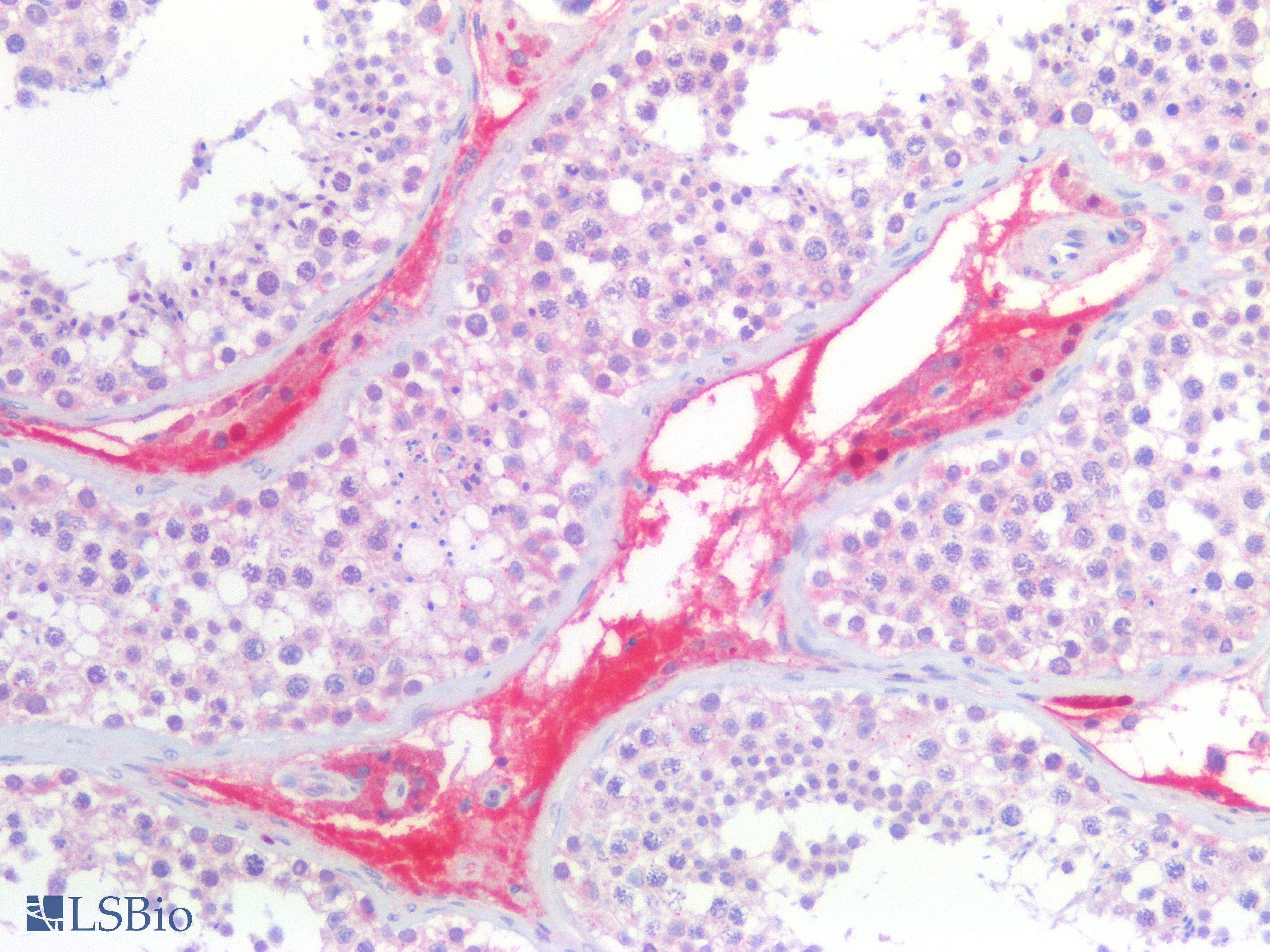 PathPlus™ CALB2 / Calretinin Antibody