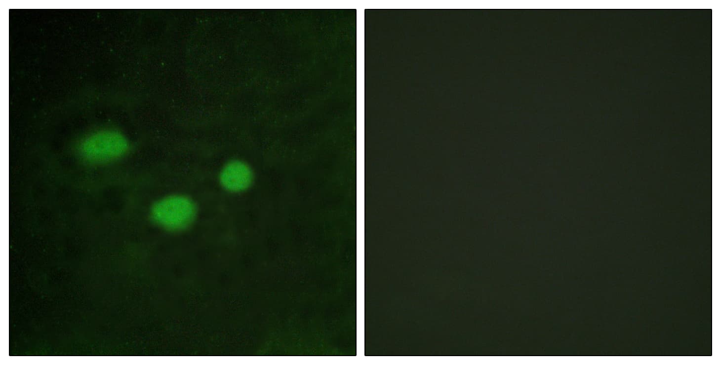 IHC-plus™ Polyclonal Rabbit anti-Human DNMT3B Antibody (aa1-50, IHC, IF, WB)