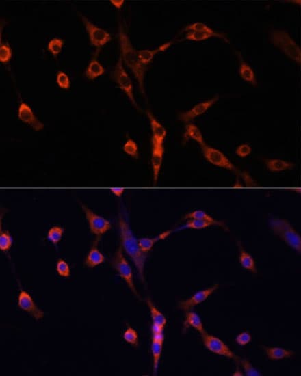 CTGF Antibody