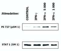 Monoclonal Mouse anti-Human STAT1 Antibody (clone SM1, Amino Acid: 721-733, IHC, WB)