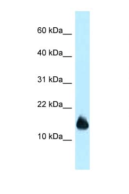 Polyclonal Rabbit anti-Mouse 1110059E24Rik Antibody (aa21-70, WB)