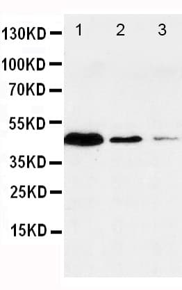 CASP1 / Caspase 1 Antibody (aa135-152)